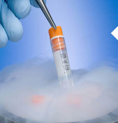 精液冷冻解冻辅助生殖技术